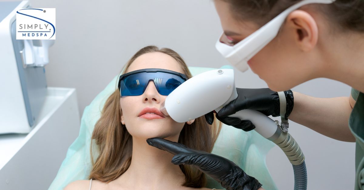 Face Laser Hair Removal in Colorado Springs: Smooth Skin Without Constant Waxing