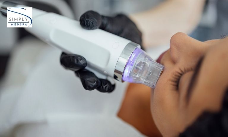 RF Microneedling in Colorado Springs: What Is Actually Happening to Your Skin During the Treatment?